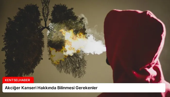 Akciğer Kanseri Hakkında Bilinmesi Gerekenler